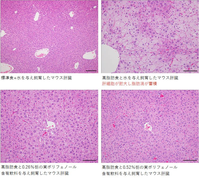 栃の実脂肪吸収抑制作用